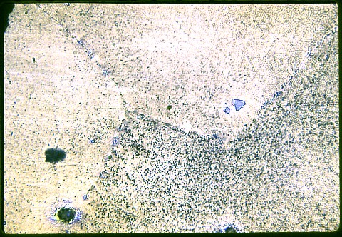 Hadfields austenitic manganese steel at 500X with Nital etch