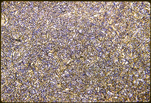 Heat treated carburized steel case at 500X etched